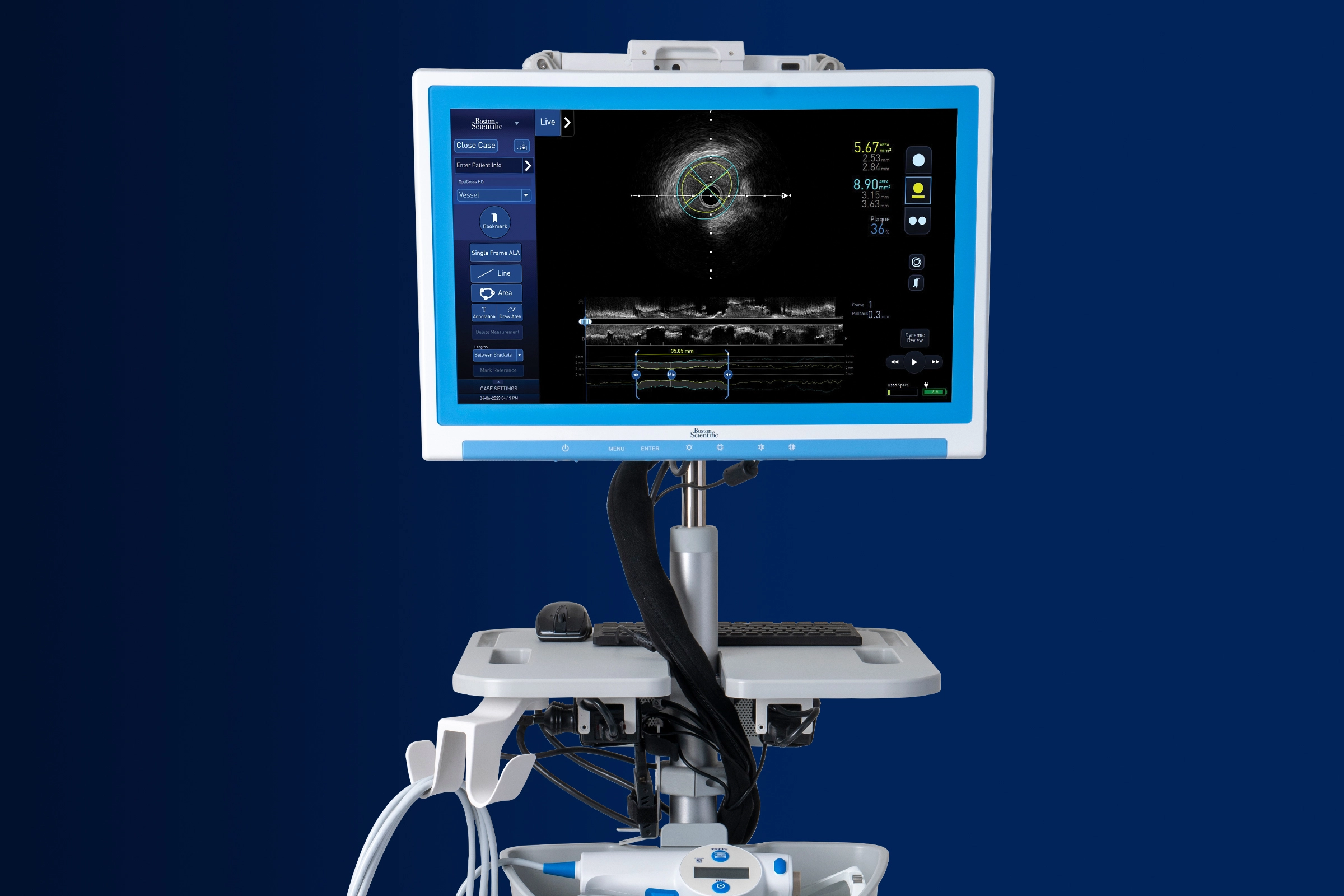 AVVIGO+ Multi-Modality Guidance System from Interventional Cardiology on a dark blue background. AVVIGO+ Multi-Modality Guidance System from Interventional Cardiology on a dark blue background.